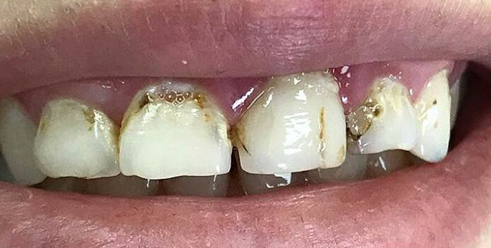 Zabiegi dentystyczne w Kass Dent