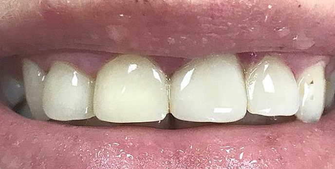 Zabiegi dentystyczne w Kass Dent